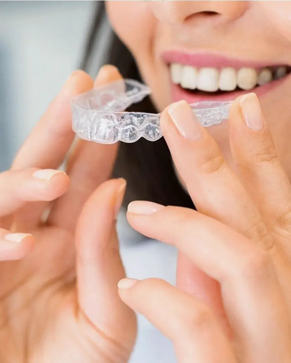 A clear aligner being placed over the upper teeth